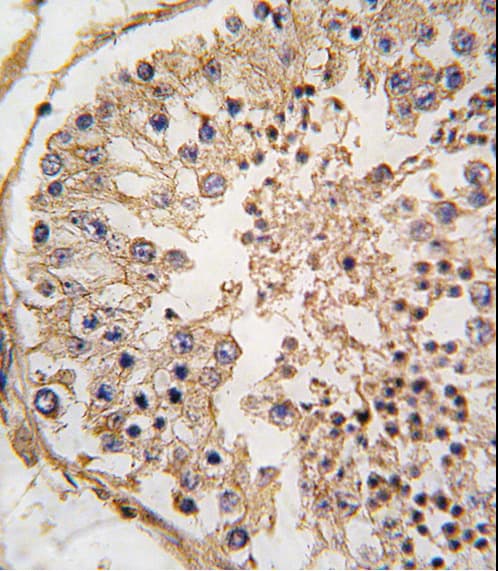 BCL2 / Bcl-2 Antibody (aa75-110)
