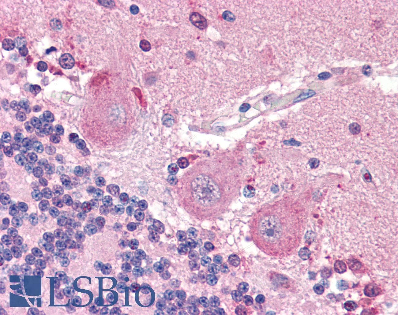 IHC-plus™ SLC6A3 / Dopamine Transporter Antibody (N-Terminus)