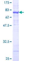 Human ASS1 / ASS Protein (Recombinant GST)