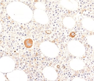 VWF / Von Willebrand Factor Antibody (clone WFA52-2)