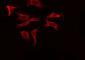FZD10 / Frizzled 10 Antibody