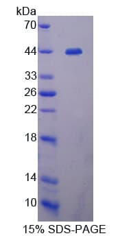 Human LTBP1 / LTBP-1 Protein (Recombinant His-T7, N-terminus)