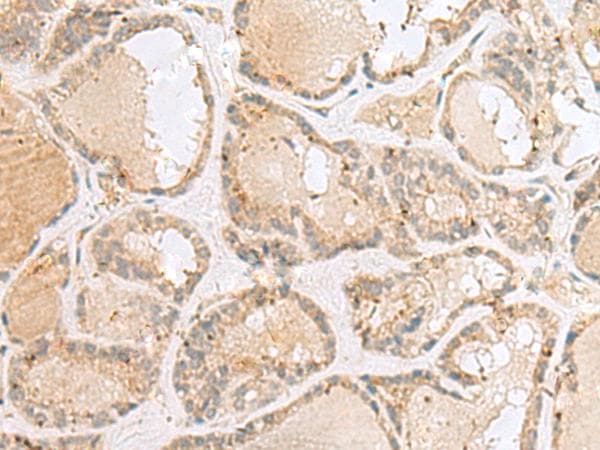 TNRC5 / CNPY3 Antibody