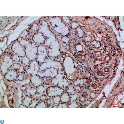 Polyclonal Rabbit anti-Human ITGAE / CD103 Antibody (WB)