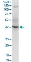 RNF2 / RING2 / RING1B Antibody (clone 2B6)