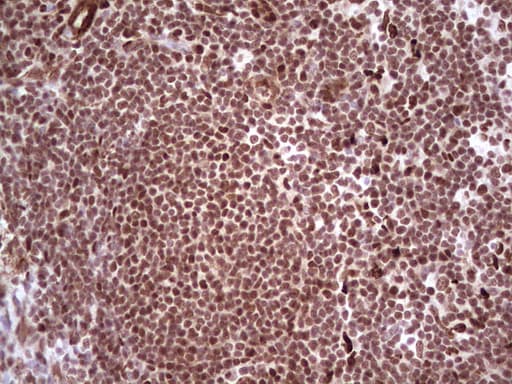 NR3C1/Glucocorticoid Receptor Antibody (aa1-265, clone OTI2C4)