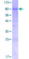 Human KDM4D / JMJD2D Protein (Recombinant GST)