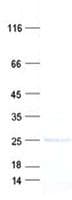 Human ARL5C Protein (Recombinant His, N-Terminal)