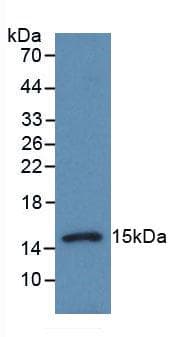 Procalcitonin Antibody (aa26-138)