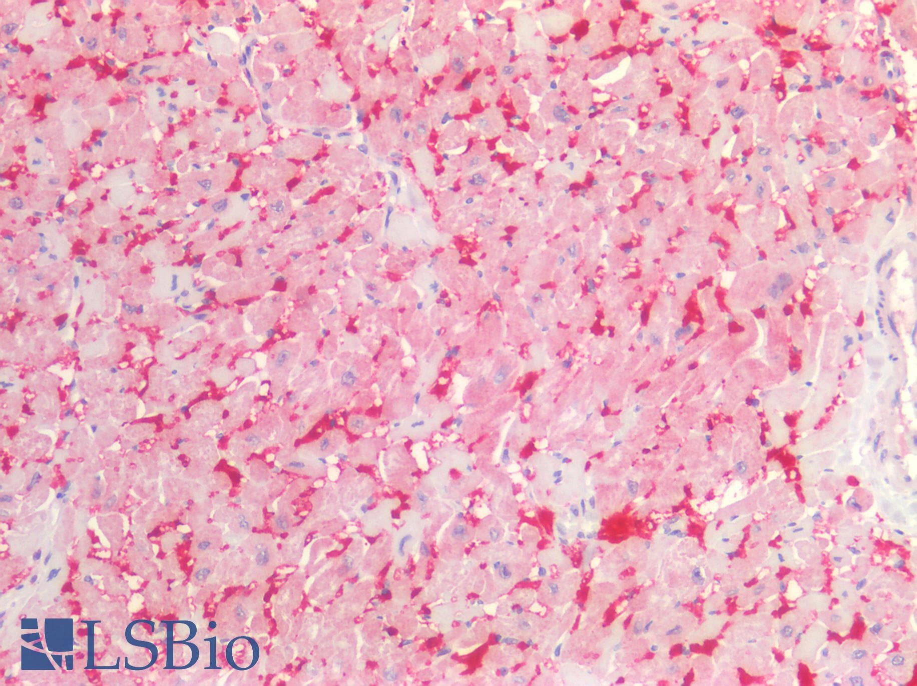 PathPlus™ Polyclonal Rabbit anti-Human INHBA / Inhibin Beta A Antibody (aa35-84, IHC, WB)