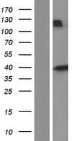 HFE Protein (Over-Expression Lysate Myc-DDK (Flag))
