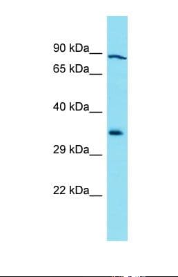 GLB1L3 Antibody (aa358-407)