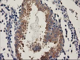 BCAR1 / p130Cas Antibody (clone OTI1B1)