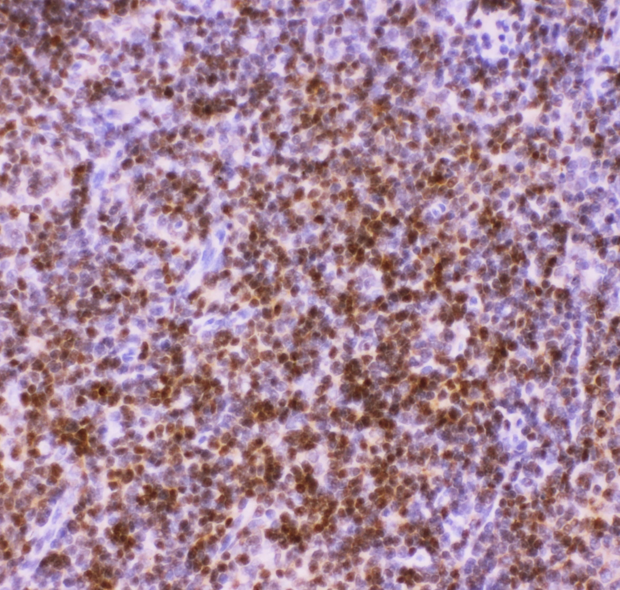 AML1 / RUNX1 Antibody (aa200-233)
