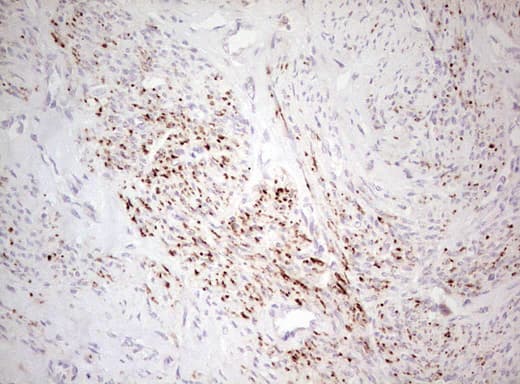Basic Cytokeratin AE3 Antibody (clone AE3)