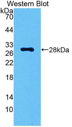 CA2 / Carbonic Anhydrase II Antibody (aa1-260)