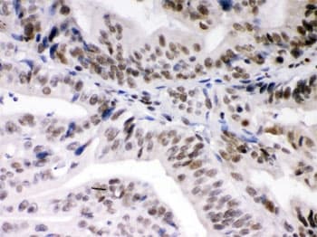 DAXX Antibody