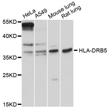 HLA-DRB5 Antibody