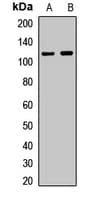 Polyclonal Rabbit anti-Human NAT10 Antibody (IF, WB)