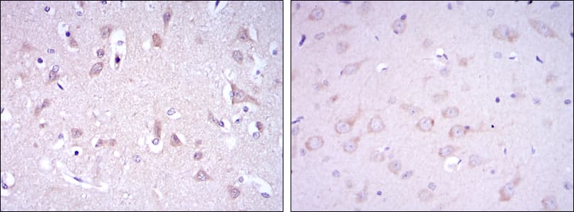 Monoclonal Mouse anti-Human GRIA3 / GLUR3 Antibody (clone 1D2, IHC, WB)