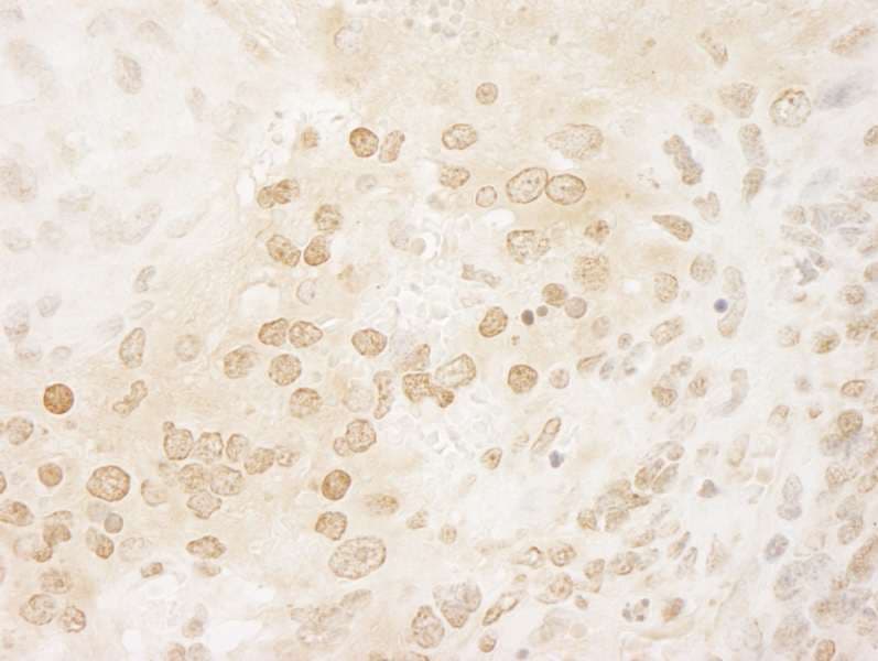 PPP5C Antibody (aa1-50)
