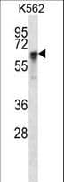 Polyclonal Rabbit anti-Human NXF1 / TAP Antibody (aa1-30, IHC, WB)