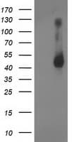 GDAP1L1 Antibody (clone OTI1A5)