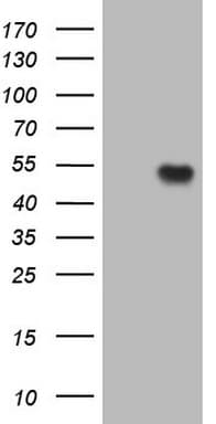 Monoclonal Mouse anti-Human VEGFD Antibody (clone OTI6C5, aa89-205, WB)