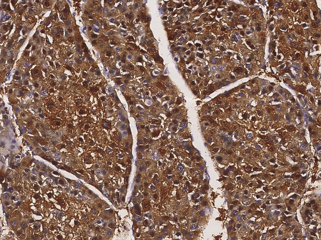ARG1 / Arginase 1 Antibody
