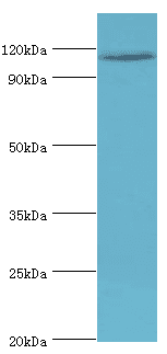 AMOT / Angiomotin Antibody (aa1-300)