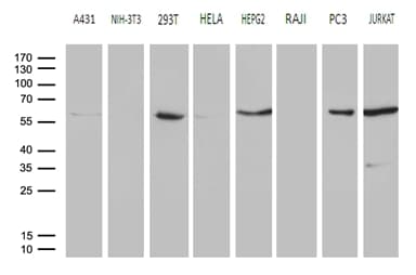 PPP3CB Antibody (aa23-96, clone OTI2E4, Carrier-free)