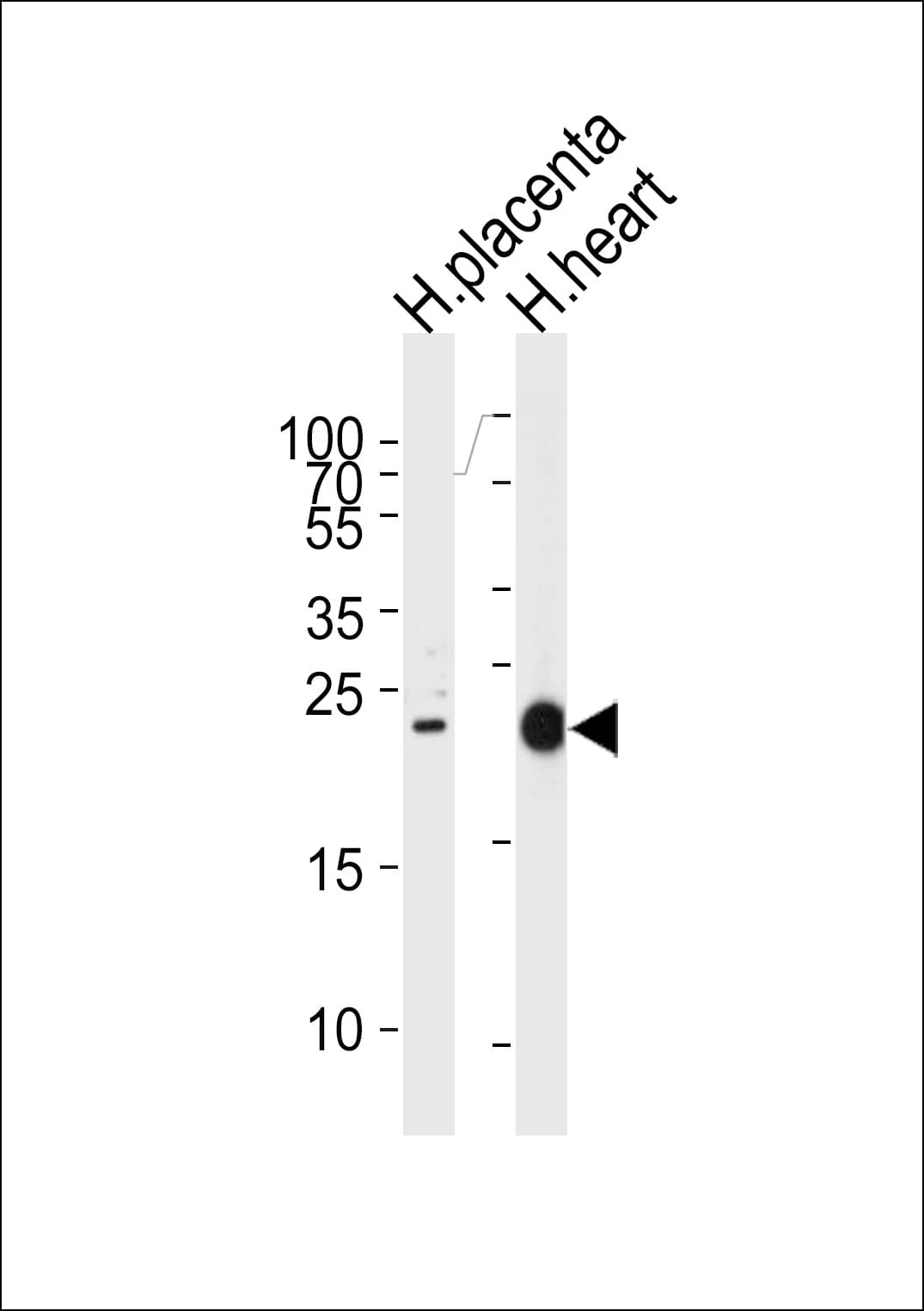 FRAT2 Antibody (aa203-230)
