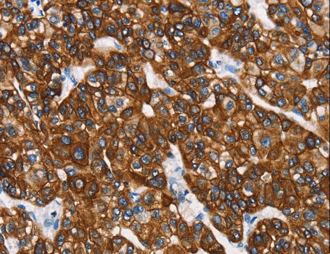 KRT8 / CK8 / Cytokeratin 8 Antibody