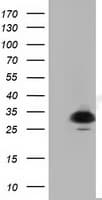 P5CR2 / PYCR2 Antibody (clone OTI2A5, Carrier-free)