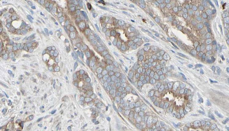 AMBRA1 Antibody