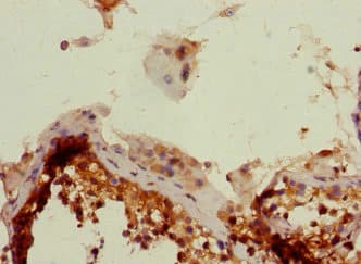 BCAP / PHF11 Antibody