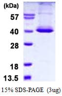 Human STK16 Protein (Recombinant His)