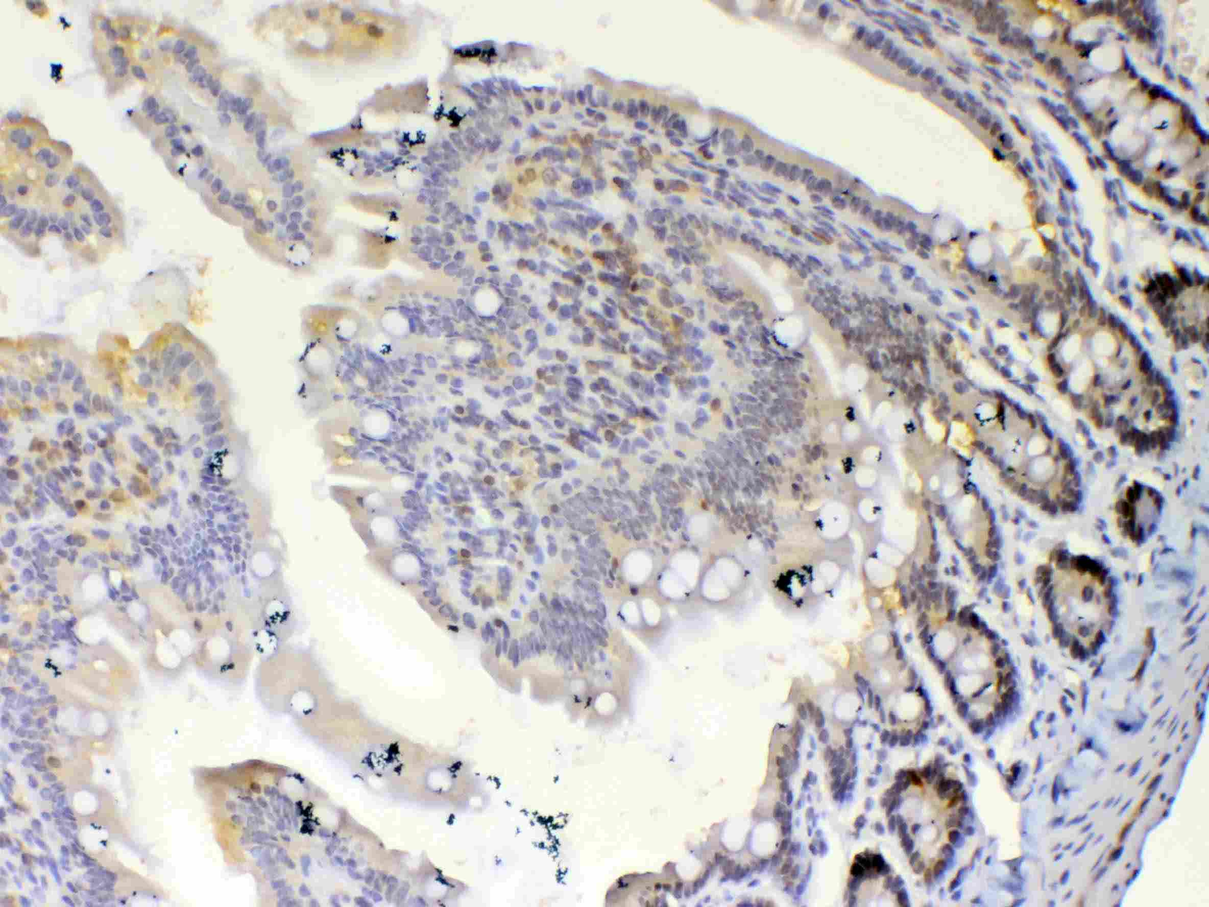 Polyclonal Rabbit anti-Human ETV6 / TEL Antibody (IHC, WB)