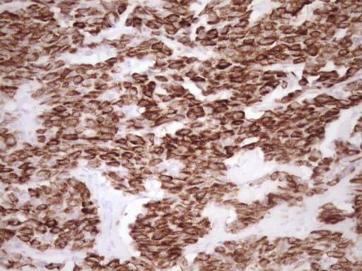 Monoclonal Mouse anti-Human KRT19 / CK19 / Cytokeratin 19 Antibody (clone OTI6A8, aa240-390, IHC, WB)