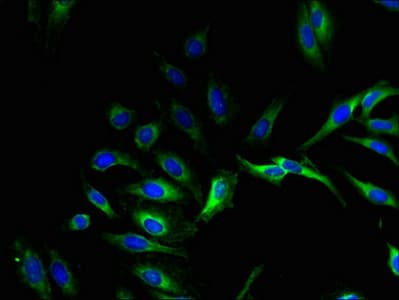 Polyclonal Rabbit anti-Human GPX8 Antibody