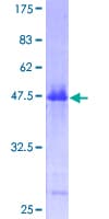 Human HRAS / H-Ras Protein (Recombinant GST)