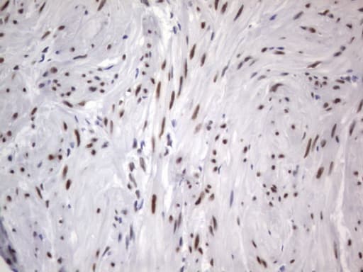 RBFOX1 / A2BP1 Antibody (aa1-210, clone OTI4F9)