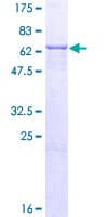 Human ENTPD5 / CD39L4 Protein (Recombinant GST)