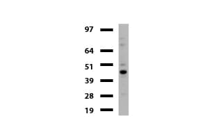 TP / Thymidine Phosphorylase Antibody (aa311-482, clone UMAB97, Carrier-free)