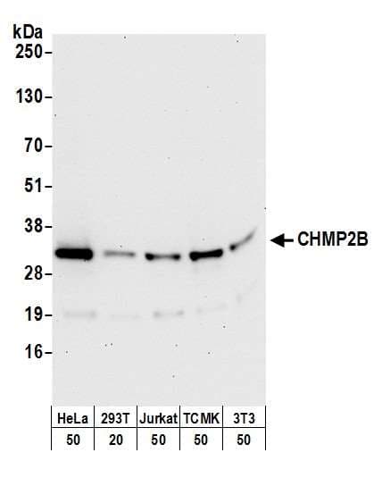 Polyclonal Rabbit anti-Human CHMP2B Antibody (aa163-213, IHC, WB)