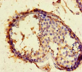 ACE2 / ACE-2 Antibody
