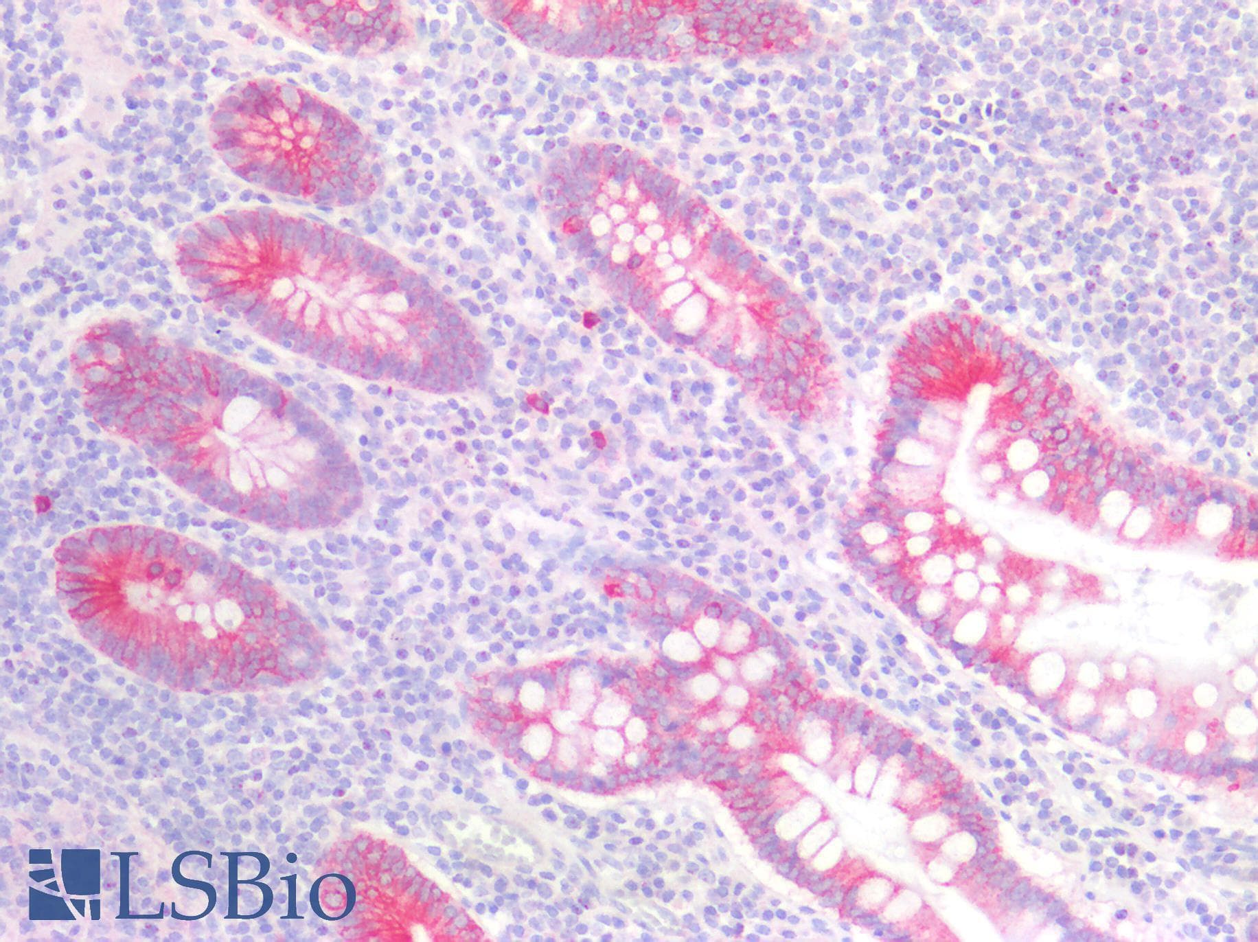 PathPlus™ GDF15 Antibody