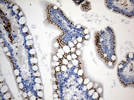 PTPN22 / PEP Antibody (aa359-449, clone OTI6B1)