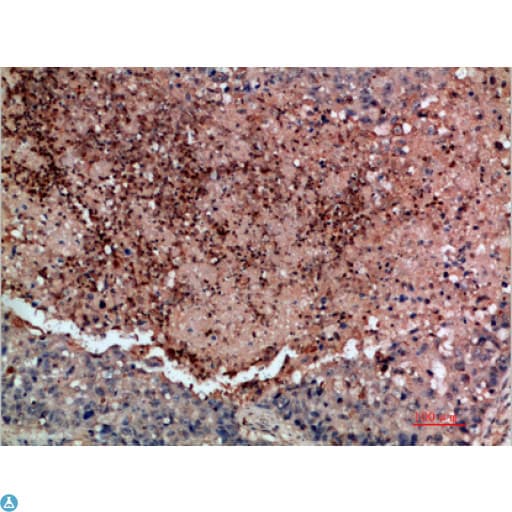 DDR2 Antibody