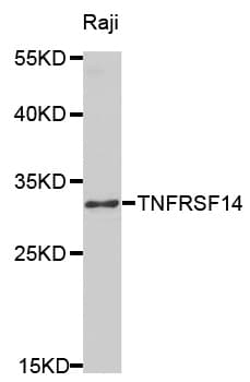 Polyclonal Rabbit anti-Human TNFRSF14 / CD270 / HVEM Antibody (IHC, WB)